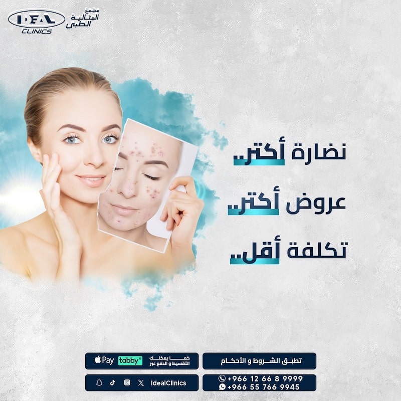 عروض عيادة جلدية وليزر جدة