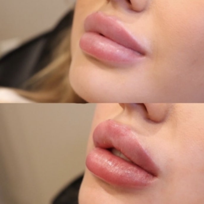 دكتورة فيلر في جدة