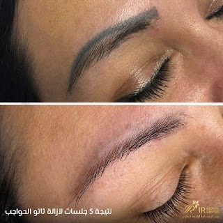 سوفت لايت للحواجب الشارقة