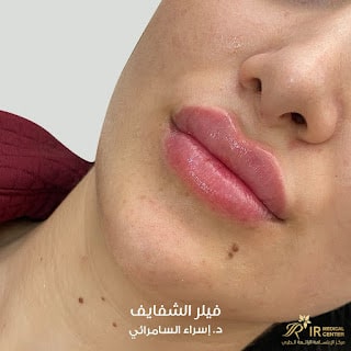 دكتورة فيلر في الشارقة